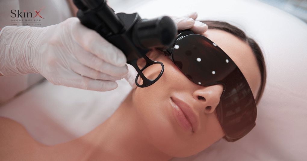 Làm sao để phục hồi da sau laser?